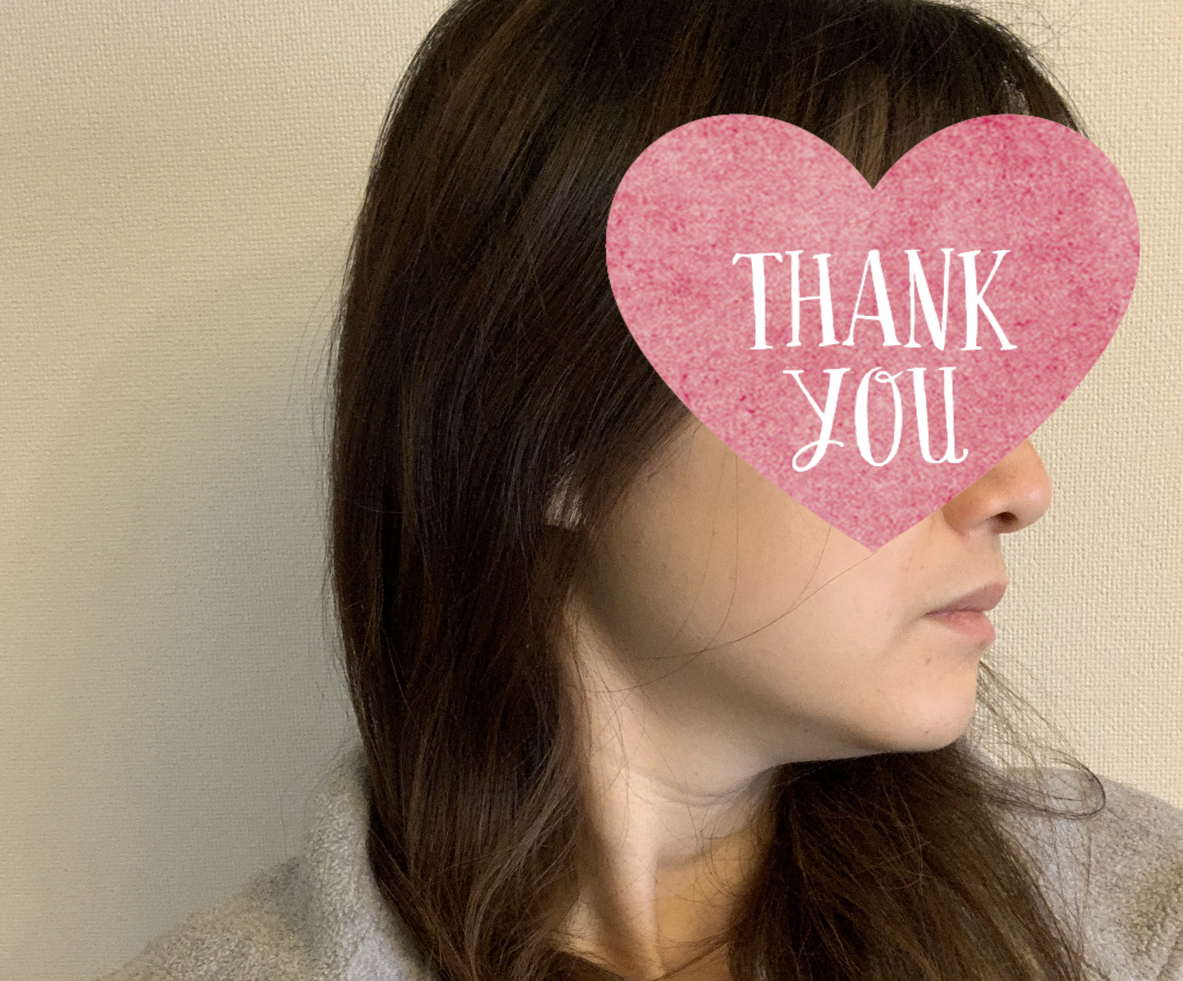 NEWAリフト継続効果