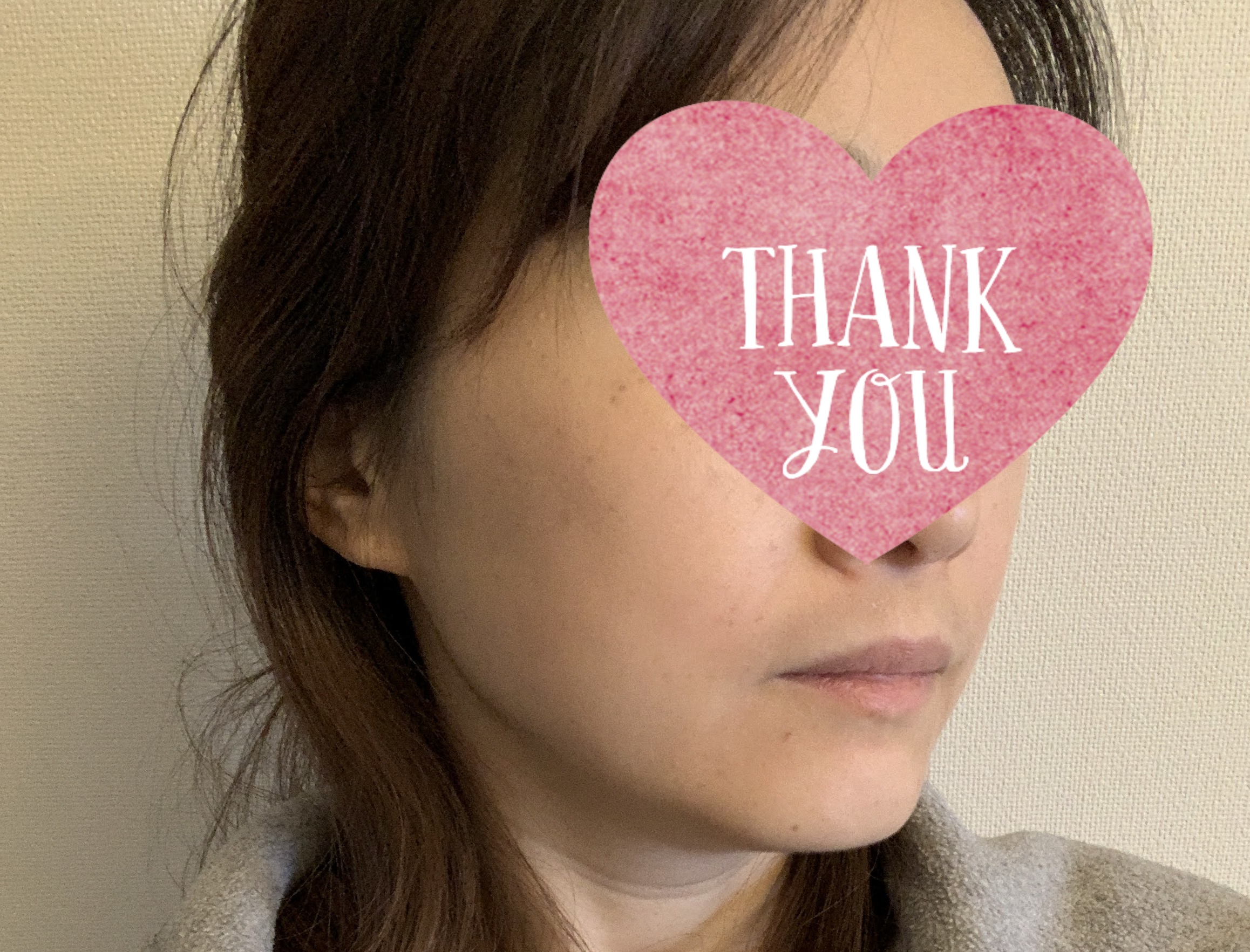 NEWAリフト継続2年後