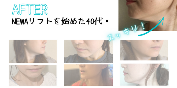 NEWAリフト使用後