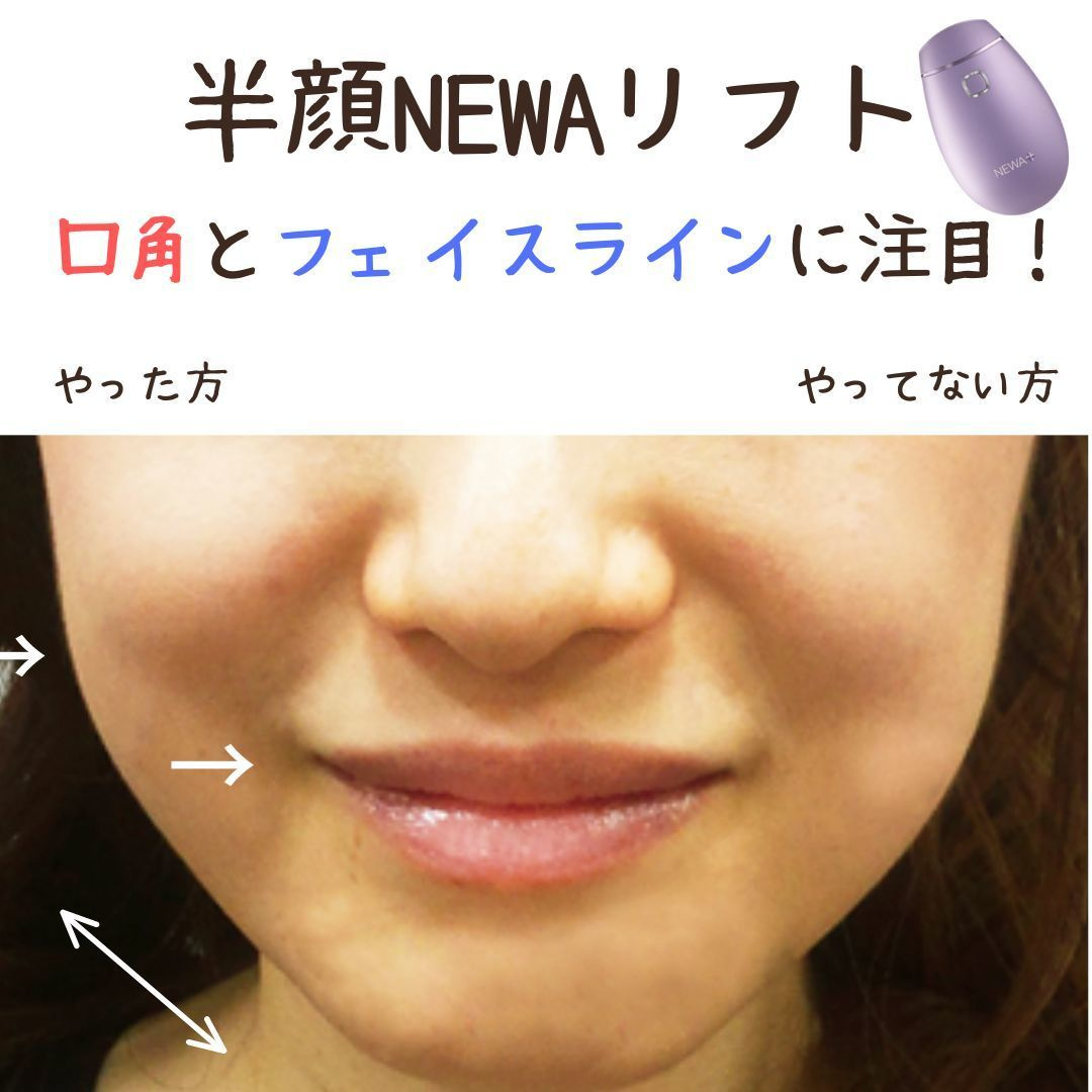 NEWAリフト効果レビュー